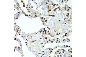 Immunohistochemistry of paraffin-embedded human normal lung using GTF2F1 antibody at dilution of 1:200 (400x lens). (GTF2F1 antibody)