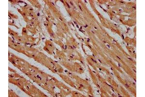 IHC image of ABIN7158901 diluted at 1:600 and staining in paraffin-embedded human heart tissue performed on a Leica BondTM system. (MPP3 antibody  (AA 301-432))