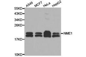 Western Blotting (WB) image for anti-Non-Metastatic Cells 1, Protein (NM23A) Expressed in (NME1) (C-Term) antibody (ABIN1873911)