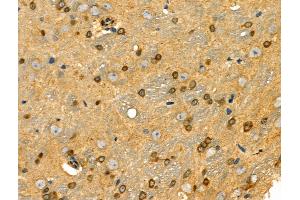 ABIN6258036 and ABIN6274198 at 1/100 staining Rat brain tissue by IHC-P. (CSRP1 antibody  (Internal Region))