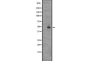 Western blot analysis of GPR83/GPR72 expression in Rat brain lysates in RIPA buffer ;developed using the ECL technique;,The lane on the left is treated with the antigen-specific peptide. (GPR83 antibody  (N-Term))