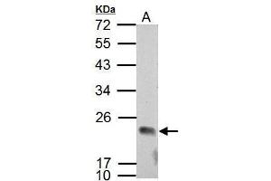 WB Image Sample (30 ug of whole cell lysate) A: NCI-H929 12% SDS PAGE antibody diluted at 1:2000 (APOBEC3C antibody  (Center))