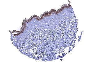 A strong KLK7 staining in the stratum granulosum and the keratinizing superficial layer of the skin (Kallikrein 7 antibody)