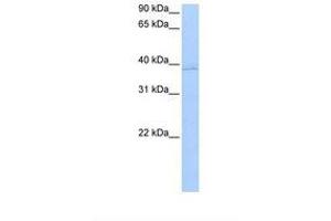 Image no. 1 for anti-Annexin A8-Like 2 (ANXA8L2) (AA 25-74) antibody (ABIN6737802) (ANXA8L2 antibody  (AA 25-74))