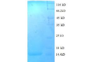 SDS-PAGE (SDS) image for Chemokine (C-C Motif) Ligand 24 (CCL24) (AA 27-119), (full length) protein (His tag) (ABIN1095507)