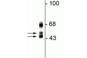 Western blot of rat cortical lysate showing specific immunolabeling of the ~46/48 kDa FOX1 protein. (A2BP1 antibody  (N-Term))