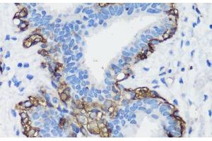 Immunohistochemistry (Paraffin-embedded Sections) (IHC (p)) image for anti-Filamin A, alpha (FLNA) antibody (ABIN7259092)