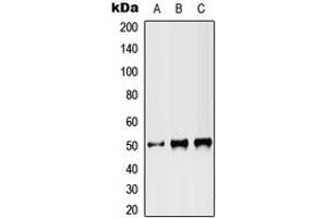 Western blot analysis of ST3N expression in HEK293T (A), NIH3T3 (B), PC12 (C) whole cell lysates. (ST3GAL3 antibody  (Center))