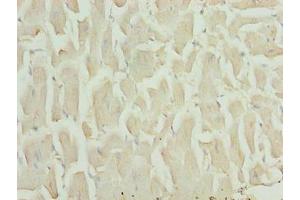 Immunohistochemistry of paraffin-embedded human heart tissue using ABIN7155873 at dilution of 1:100 (HOPX antibody  (AA 1-73))