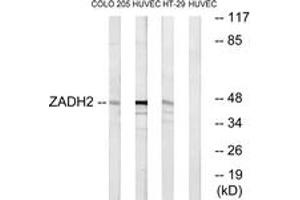 Western blot analysis of extracts from HuvEc/HT-29/COLO cells, using ZADH2 Antibody. (ZADH2 antibody  (AA 191-240))