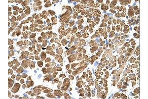 Immunohistochemistry (IHC) image for anti-Tropomyosin-2 (TPM2) (C-Term) antibody (ABIN2783288) (TPM2 antibody  (C-Term))