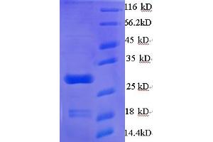 SDS-PAGE (SDS) image for phospholipase A2, Group V (PLA2G5) (AA 21-137) protein (His-SUMO Tag) (ABIN5710107)