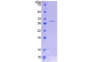SDS-PAGE of Protein Standard from the Kit (Highly purified E. (Phenylalanine Hydroxylase ELISA Kit)