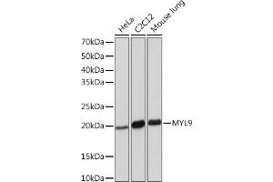 Western blot analysis of extracts of various cell lines, using MYL9 Rabbit mAb (ABIN7268755) at 1:1000 dilution. (MYL9 antibody)
