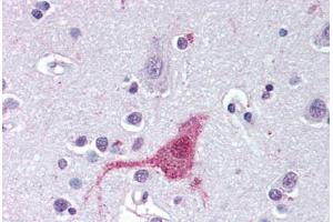 Anti-EDNRB antibody  ABIN1048558 IHC staining of human brain, cortex. (EDNRB antibody  (N-Term))