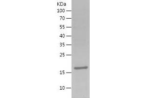 FAM20C Protein (AA 102-244) (His tag)