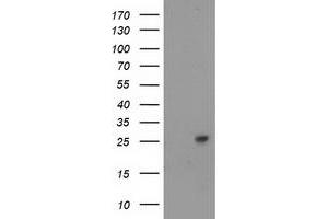 HEK293T cells were transfected with the pCMV6-ENTRY control (Left lane) or pCMV6-ENTRY CDKN3 (Right lane) cDNA for 48 hrs and lysed. (CDKN3 antibody)