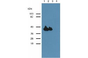 Western blotting analysis of muscle-specific actin using the monoclonal antibody HHF35. (Actin antibody)