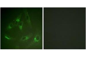 Immunofluorescence analysis of HeLa cells, using CSFR (Ab-561) Antibody. (CSF1R antibody  (AA 531-580))