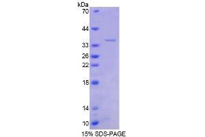 SDS-PAGE analysis of Human TSC22 Protein. (TSC22D1 Protein)