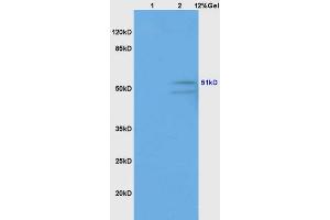 Lane 1: human colon carcinoma lysates Lane 2: mouse brain lysates probed with Anti GABRG2/GABA A Receptor gamma 2 Polyclonal Antibody, Unconjugated (ABIN754003) at 1:200 in 4 °C. (GABRG2 antibody  (AA 41-140))