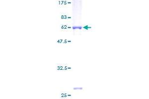 AKR1B10 Protein (AA 1-316) (GST tag)