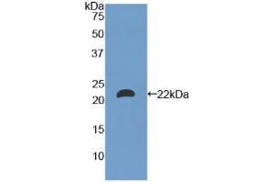 Western blot analysis of recombinant Mouse LAMa1. (Laminin alpha 1 antibody  (AA 2640-2773))