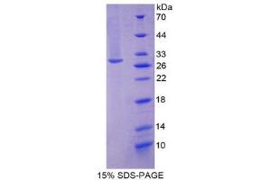 SDS-PAGE (SDS) image for Centromere Protein F (CENPF) (AA 436-637) protein (His tag) (ABIN2124292) (CENPF Protein (AA 436-637) (His tag))