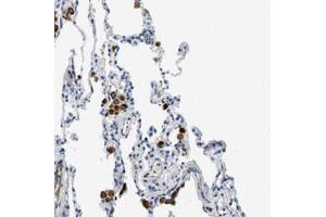 Immunohistochemical staining (Formalin-fixed paraffin-embedded sections) of human lung with XCR1 polyclonal antibody  shows strong cytoplasmic positivity in macrophages. (XCR1 antibody)