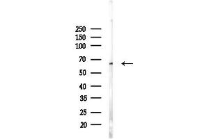 anti-Membrane Protein, Palmitoylated 5 (MAGUK P55 Subfamily Member 5) (MPP5) (C-Term) antibody