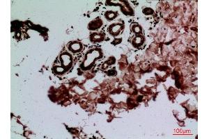 Immunohistochemistry (IHC) analysis of paraffin-embedded Human Skin, antibody was diluted at 1:100. (CEACAM1/5 antibody  (N-Term))