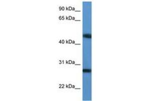 TM2D2 Antikörper  (AA 97-146)