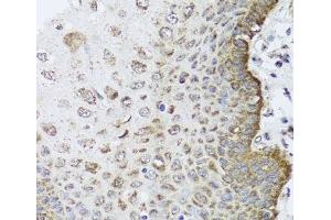 Immunohistochemistry of paraffin-embedded Human esophagus using FANCL Polyclonal Antibody at dilution of 1:100 (40x lens). (FANCL antibody)