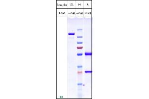 Product on SDS-PAGE under non-reducing (NR) and reducing (R) conditions.