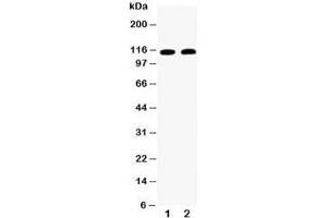 Western blot testing of Desmoglein 3 antibody and Lane 1:  A431;  2: CEM (Desmoglein 3 antibody  (AA 981-999))