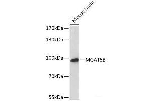 Western blot analysis of extracts of Mouse brain using MGAT5B Polyclonal Antibody at dilution of 1:3000. (MGAT5B antibody)
