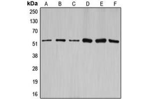 Western blot analysis of Cyclin A1/2 expression in HEK293T (A), NIH3T3 (B), rat brain (C), SW626 (D), SKOV3 (E), A2780 (F) whole cell lysates. (Cyclin-A1-2 antibody  (Center))