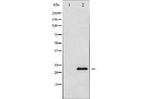 Western blot analysis SOCS2 using COS7 whole cell lysates (SOCS2 antibody)