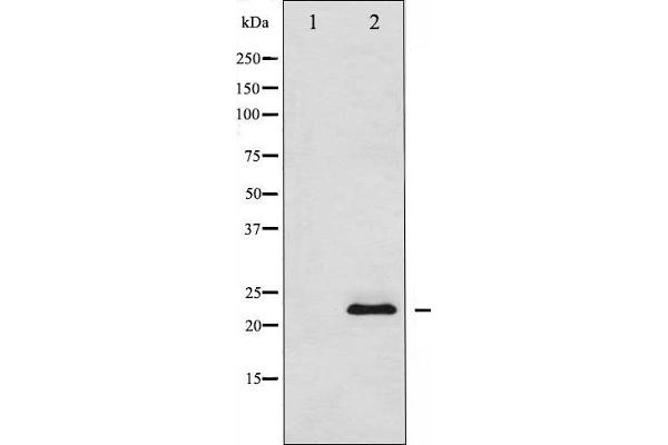 SOCS2 antibody