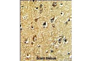 Formalin-fixed and paraffin-embedded human brain tissue with TH Antibody (C-term), which was peroxidase-conjugated to the secondary antibody, followed by DAB staining. (TH antibody  (C-Term))