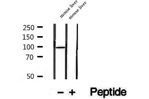 Western blot analysis of extracts of mouse liver tissue, using STT3B antibody. (STT3B antibody  (C-Term))