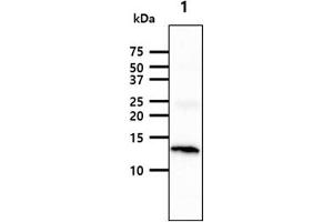 The tissue lysate (40ug) were resolved by SDS-PAGE, transferred to PVDF membrane and probed with anti-human FABP3 antibody (1:1000).