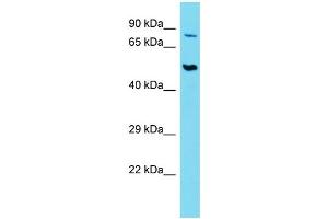 Host:  Rabbit  Target Name:  SLC44A2  Sample Type:  Thymus Tumor lysates  Antibody Dilution:  1. (SLC44A2 antibody  (Middle Region))
