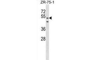 Western Blotting (WB) image for anti-PDZ Domain Containing 3 (PDZD3) antibody (ABIN2999605)