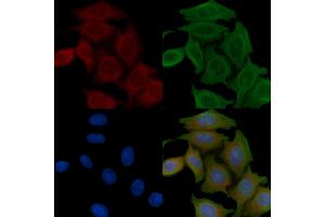 ABIN6258953 and ABIN6276209 staining Hela cells(45 min of heat-shock) by IF/ICC. (QRFPR antibody  (Internal Region))