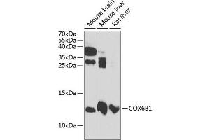 Western blot analysis of extracts of various cell lines, using COX6B1 antibody (ABIN6131579, ABIN6138917, ABIN6138918 and ABIN6216044) at 1:3000 dilution. (COX6B1 antibody  (AA 1-86))