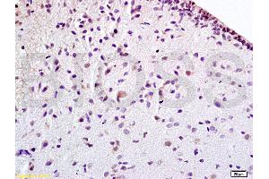 Formalin-fixed and paraffin embedded rat brain tissue labeled withAnti-EPOR Polyclonal Antibody (ABIN686347), Unconjugated at 1:100 followed by conjugation to the secondary antibody, (SP-0023), and DAB staining (EPOR antibody  (AA 301-450))