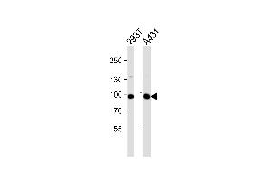 Western blot analysis of lysates from 293T, A431 cell line (from left to right), using IL4R Antibody (C-term) (ABIN1944783 and ABIN2838524). (IL4 Receptor antibody  (C-Term))