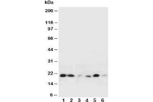 Western blot testing of HSPB2 antibody and Lane 1:  rat liver;  2: rat spleen;  3: human HeLa;  4: (h) COLO320;  5: (h) HT1080;  6: (h) MCF-7 cell lysate (HSPB2 antibody  (Middle Region))