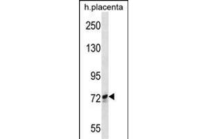 SCYL1 Antibody (N-term) (ABIN652299 and ABIN2841349) western blot analysis in human placenta tissue lysates (35 μg/lane). (SCYL1 antibody  (N-Term))